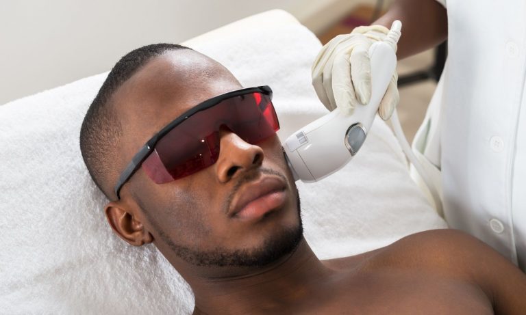 Laser Hair Removal On Lip